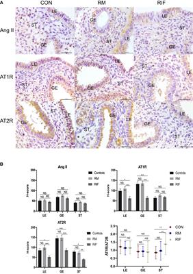 Association of angiotensin II and receptors in peri-implantation endometrium with microvessel density and pregnancy outcomes of women with recurrent implantation failure after embryo transfer